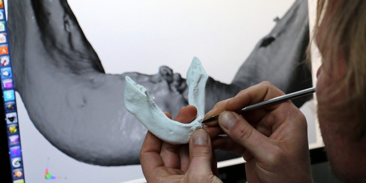 jaw bone